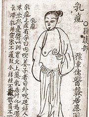 乳腺膿腫圖