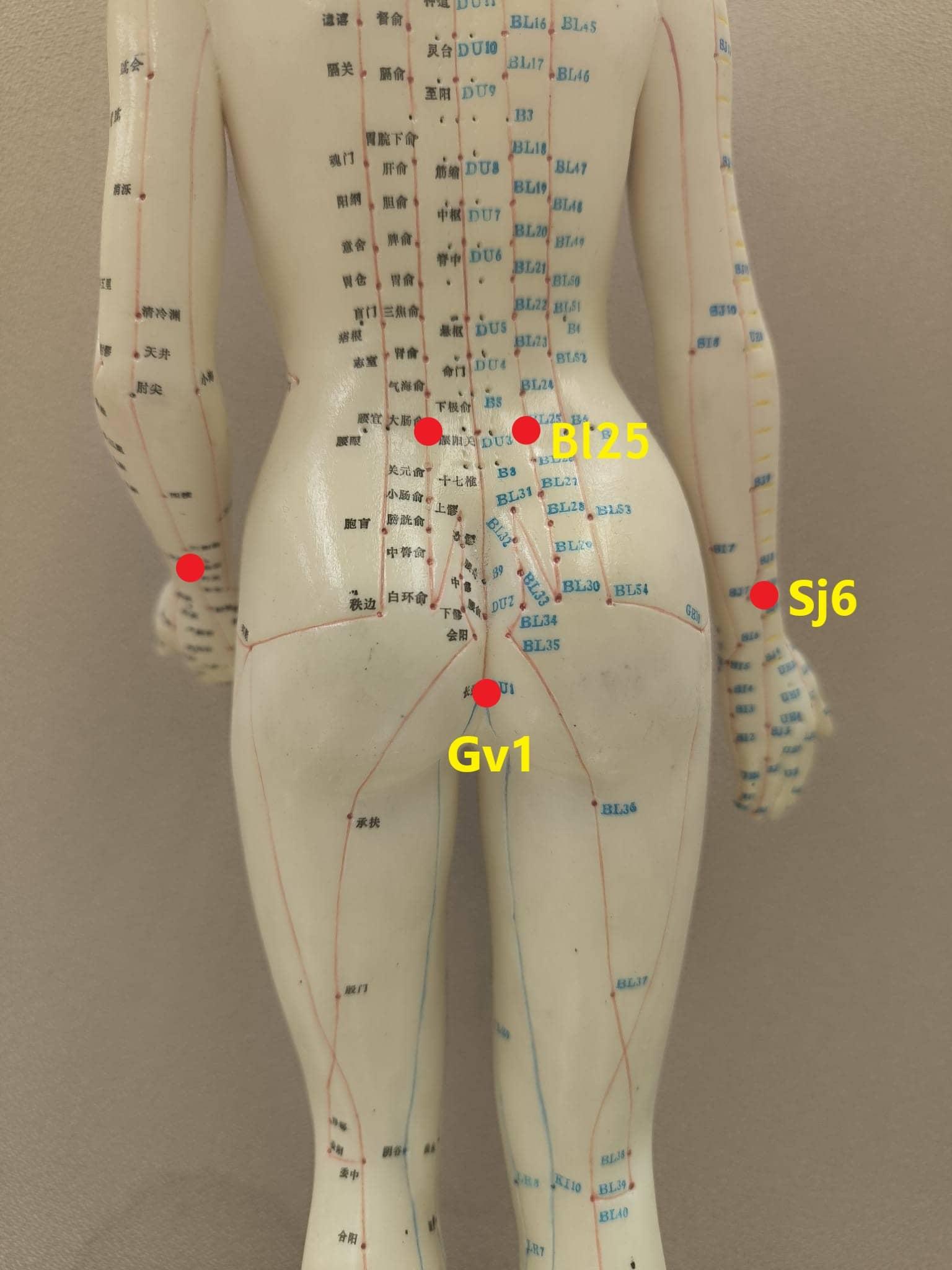 Point Application Therapy Chinese Acupuncture Therapy for Constipation