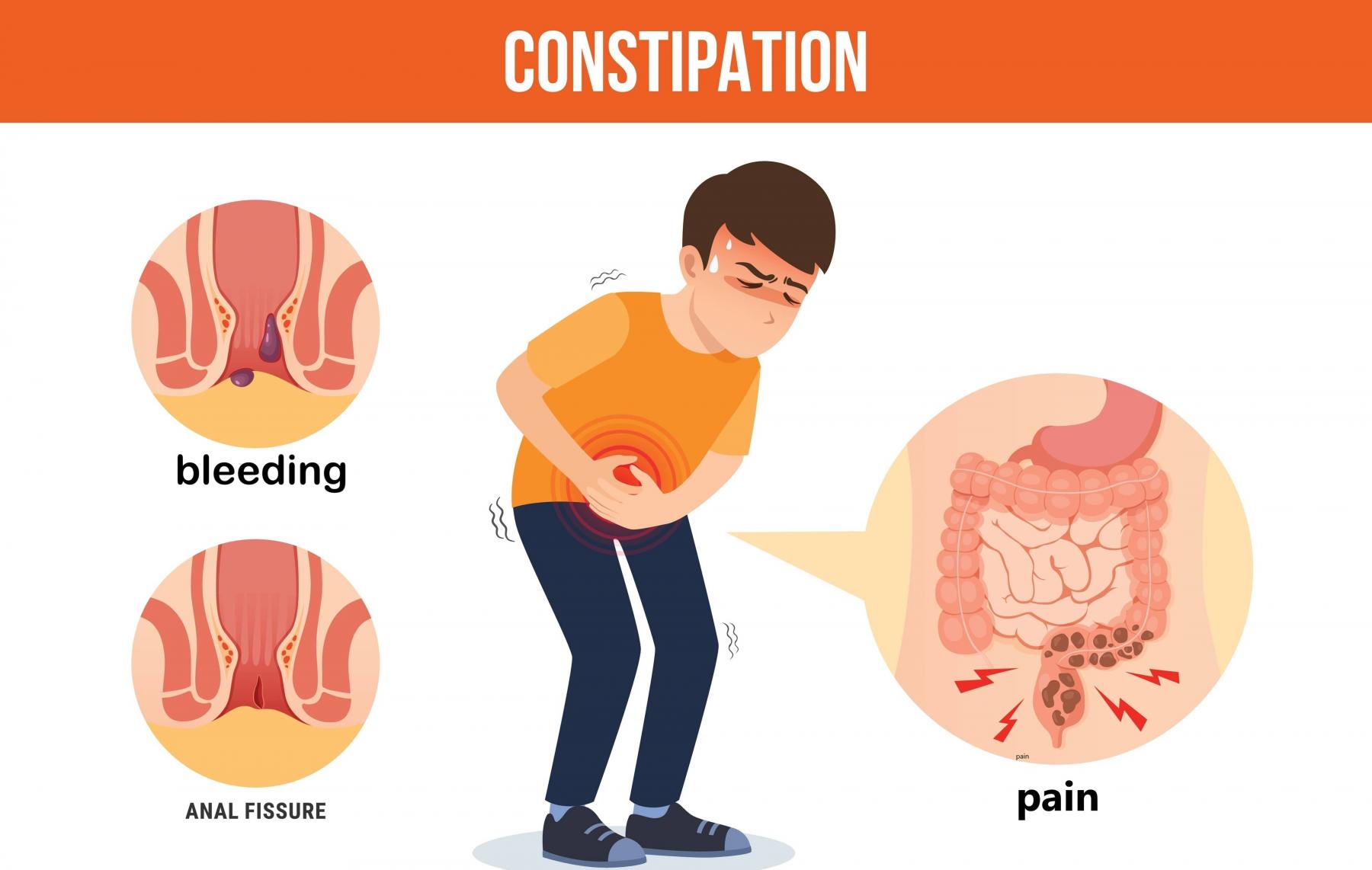 constipation complications