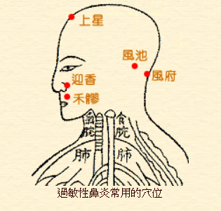 過敏性鼻炎針灸穴位