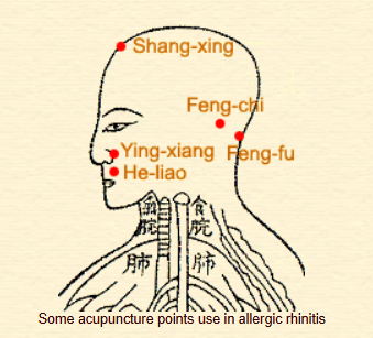 acupoints for allergic rhinitis