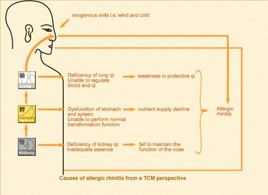 development of allergic rhinitis from a TCM perspective