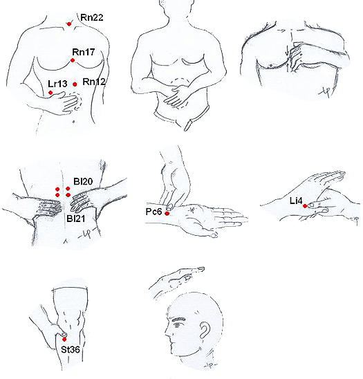 Acupressure for relieving hiccups