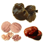 Winter foods: Chinese dates, black fungus and walnuts.